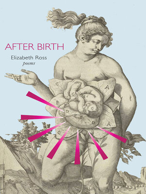 cover image of After Birth